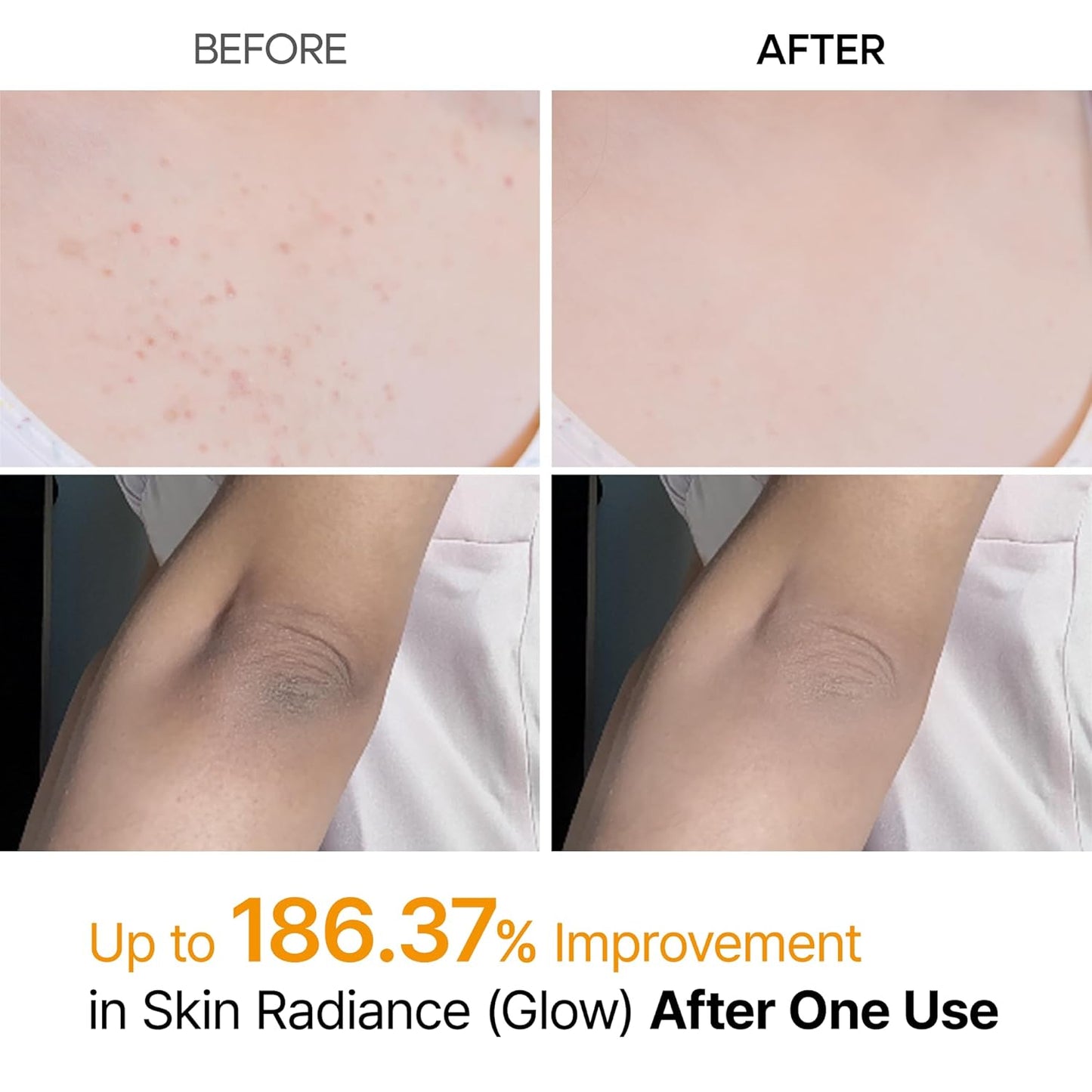 Virexa™ - Body Peel Spray Kojic + Turmeric
