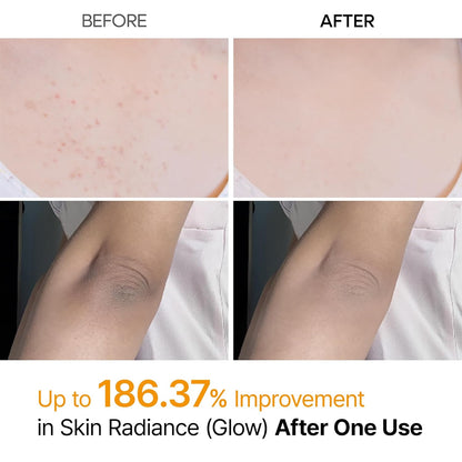 Virexa™ - Body Peel Spray Kojic + Turmeric