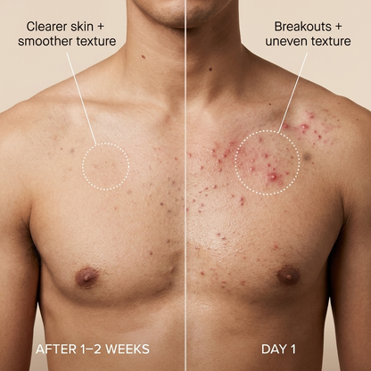 Kojic + Turmeric Body Peelshot Spray
